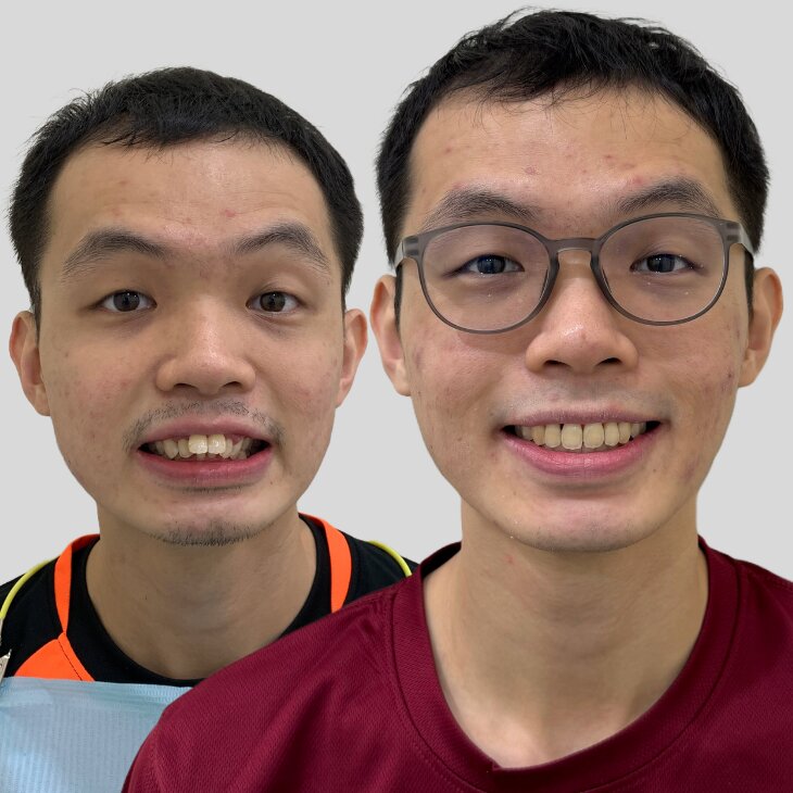 bro2